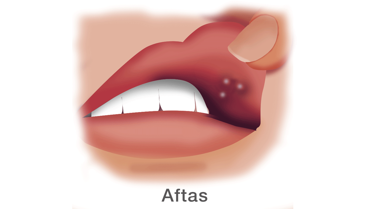 Próximamente en WikiFarmacia
