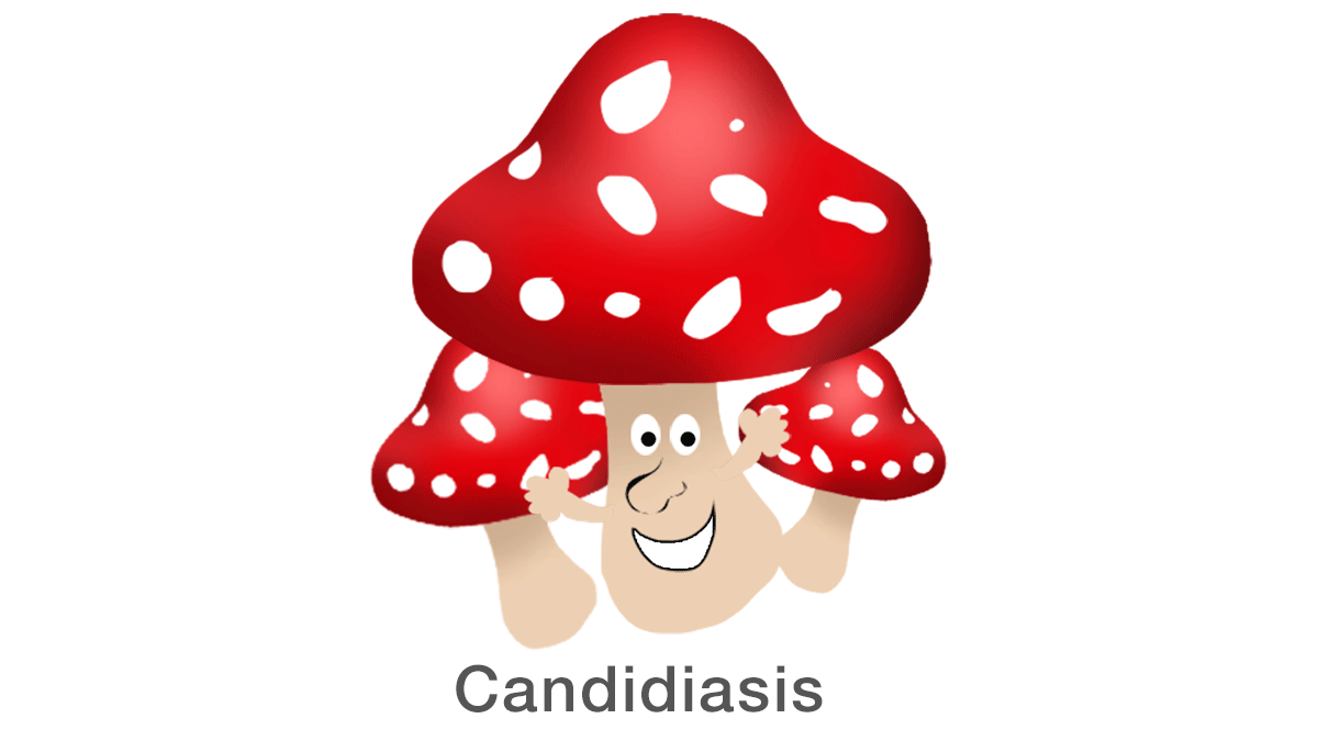 Candidiasis