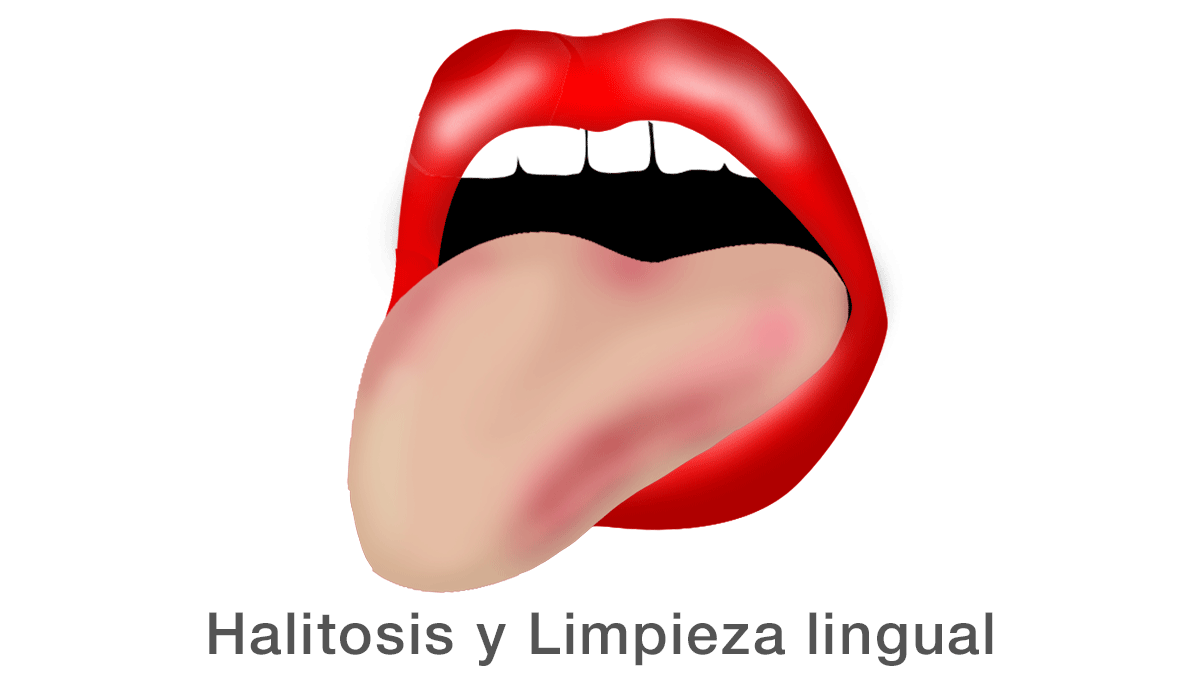 Halitosis y limpieza lingual