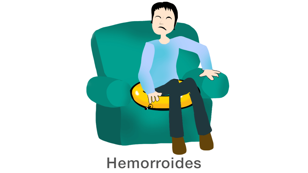 Hemorroides