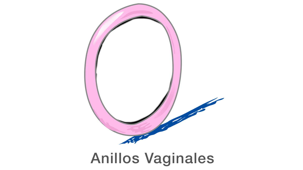 Anillos vaginales
