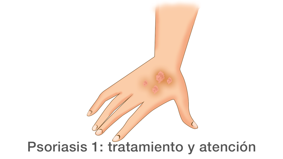 Psoriasis 1ª parte