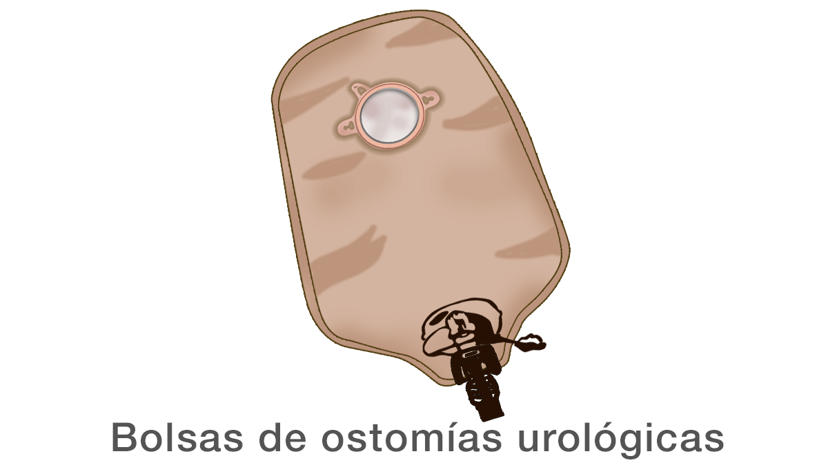 Bolsas de ostomías urológicas