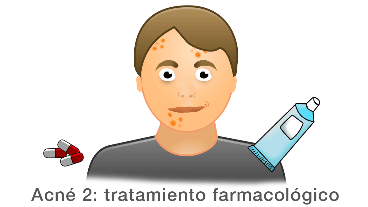 Acné 2