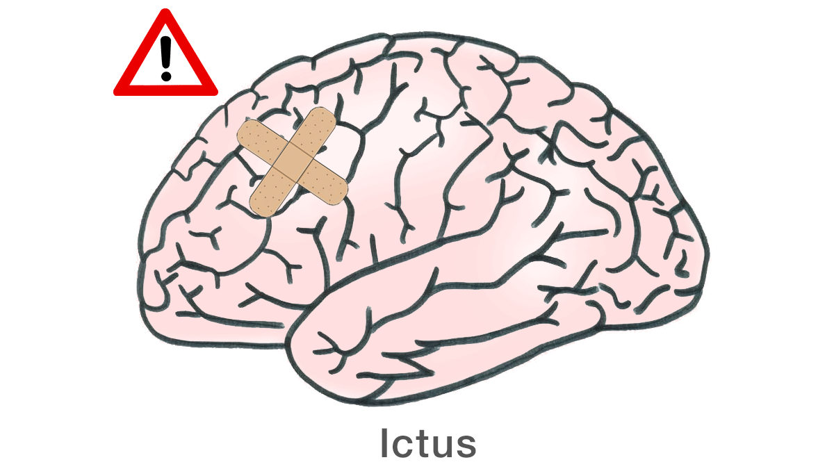 Ictus