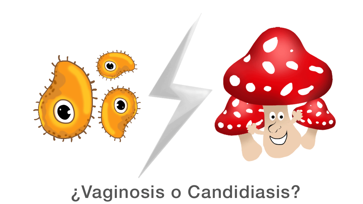 ¿Vaginosis o Candidiasis?